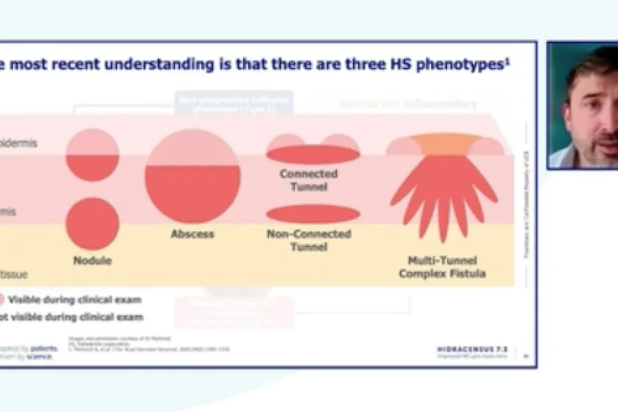 thumbnail webinar 2