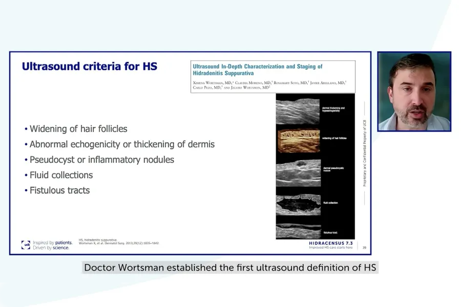 250715_Use of imaging in HS management_thumbnail Med Hub.png