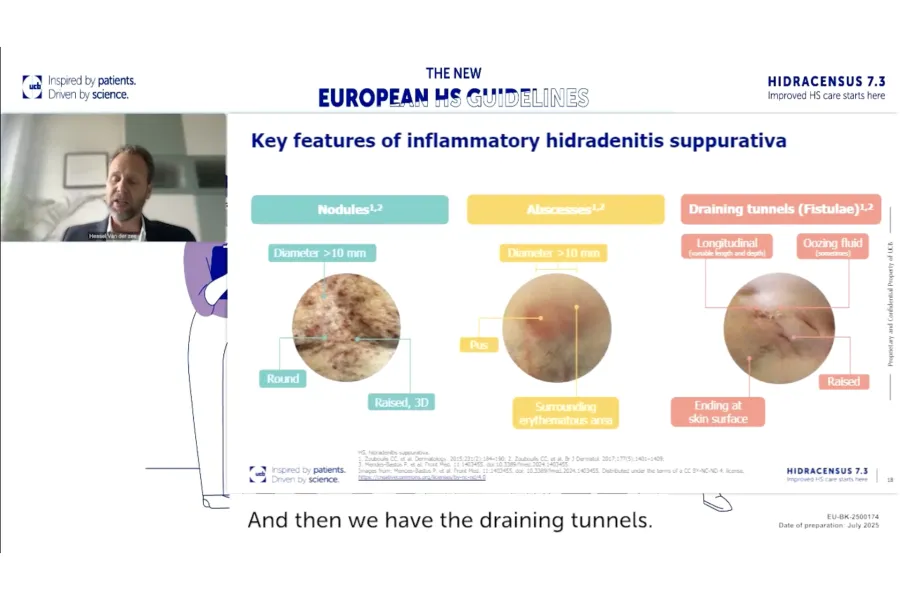 UCB Hidracensus 7.3 HS Awareness Week WEBINAR_1