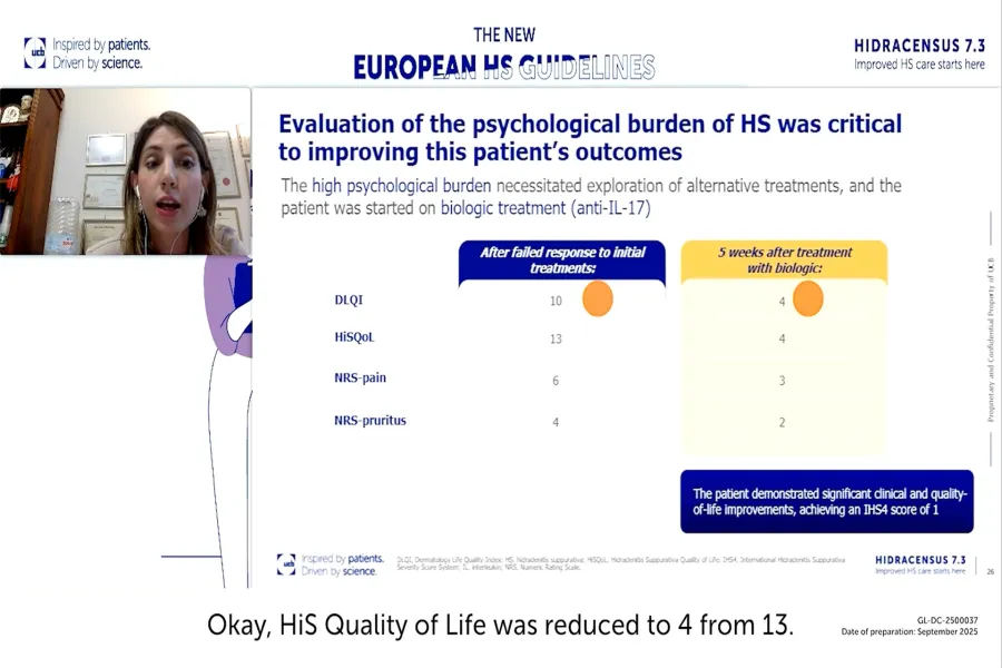 Hidracensus 7.3 HS webinar 2 bitesize 1_AFD