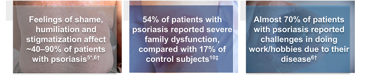 The impacts of psoriasis on QoL