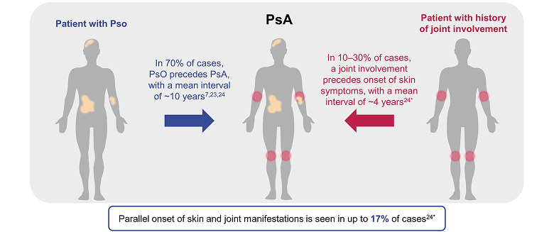 Most patients present with psoriasis before PsA