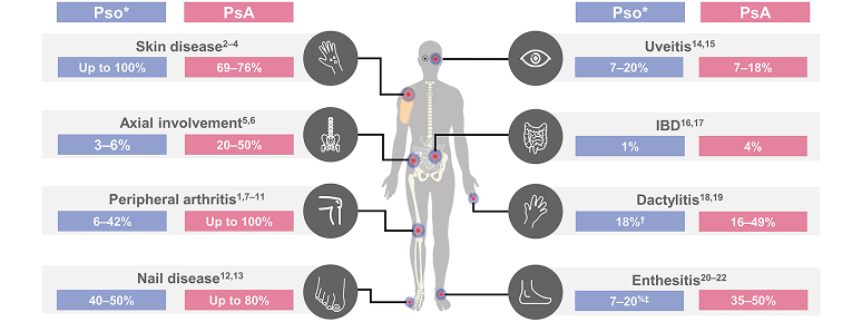 Overview of comorbidities with psoriasis or psoriatic arthritis