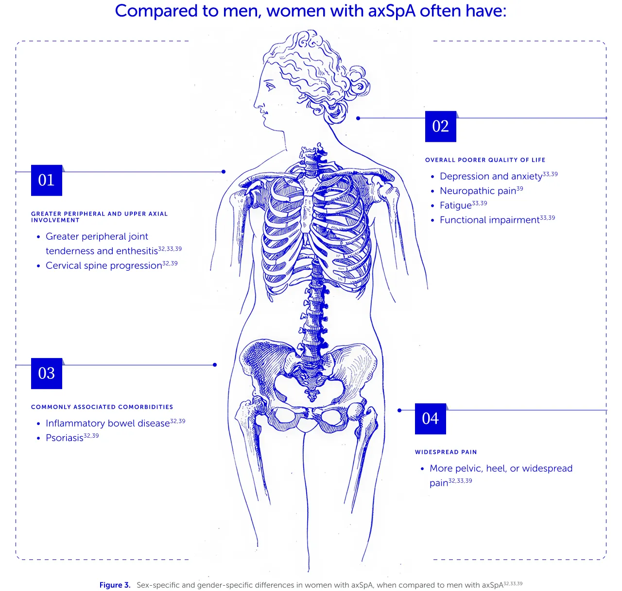 Line drawing of woman with partly visible skeleton, annotated with axSpA traits experienced more commonly in women than men
